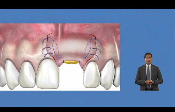 Giorgio-Tabanella-lecturing