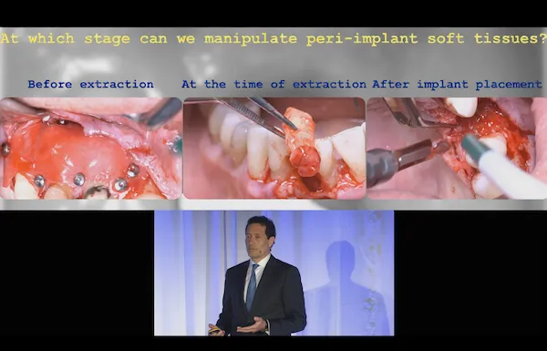 Giorgio Tabanella on stage